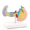 Disease Anatomical Model of the Pancreas, Spleen and Gallbladder