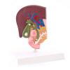Model of a gallbladder with gallstones