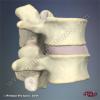 3D Anatomy for Chiropractic Spine