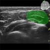 3D Anatomy MSK Ultrasound Upper and Lower Limb