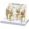 Canine Osteoarthritis Knee Model Set