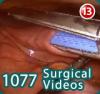 World Electronic Book of Surgery (WeBSurg)
